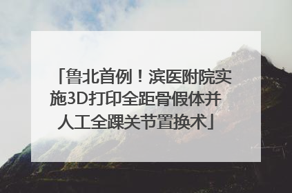 鲁北首例！滨医附院实施3D打印全距骨假体并人工全踝关节置换术